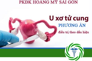 U xơ tử cung dấu hiệu và phương pháp điều trị phù hợp